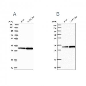 Anti-TBCB antibody produced in rabbit 