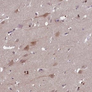 Anti-TBCB antibody produced in rabbit 