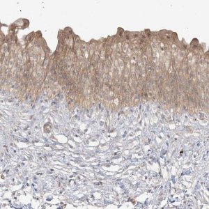 Anti-TBCC antibody produced in rabbit 