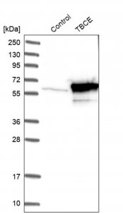 Anti-TBCE antibody produced in rabbit 