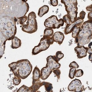 Anti-TBCE antibody produced in rabbit 