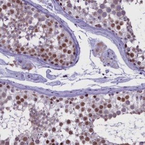 Anti-TBL3 antibody produced in rabbit 