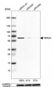Anti-TBRG4 antibody produced in rabbit 