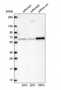 Anti-TBRG4 antibody produced in rabbit 