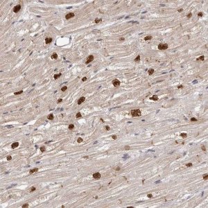 Anti-TBX5 antibody produced in rabbit 