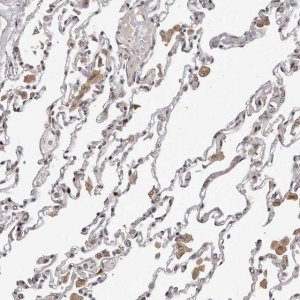 Anti-TBX5 antibody produced in rabbit 