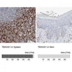 Anti-TBXAS1 antibody produced in rabbit 