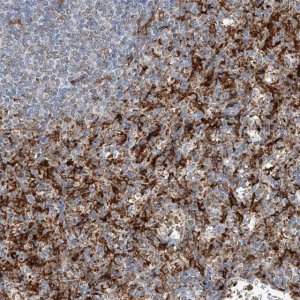 Anti-TBXAS1 antibody produced in rabbit 