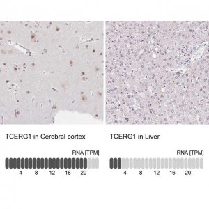 Anti-TCERG1 antibody produced in rabbit 