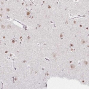 Anti-TCERG1 antibody produced in rabbit 