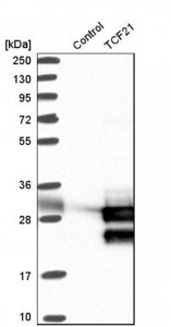 Anti-TCF21 antibody produced in rabbit 