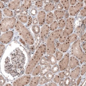 Anti-TCF21 antibody produced in rabbit 