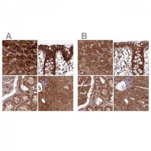 Anti-TCF25 antibody produced in rabbit HPA041699-100UL