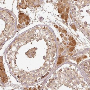 Anti-TCL1B antibody produced in rabbit 
