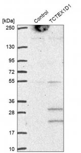 Anti-TCTEX1D1 antibody produced in rabbit 