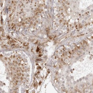 Anti-TCTEX1D1 antibody produced in rabbit 