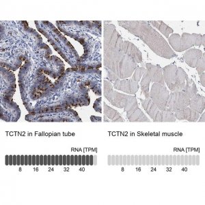 Anti-TCTN2 antibody produced in rabbit 