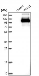 Anti-TCTN2 antibody produced in rabbit 