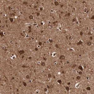 Anti-TECPR2 antibody produced in rabbit 