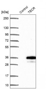 Anti-TECR antibody produced in rabbit HPA056488-100UL