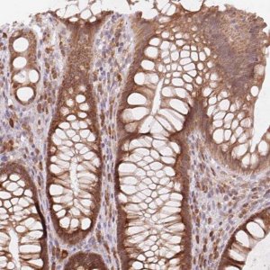 Anti-TECR antibody produced in rabbit HPA056488-100UL