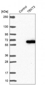 Anti-TEKT3 antibody produced in rabbit HPA044354-100UL