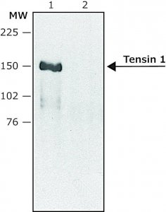Anti-Tensin 1 (internal) antibody produced in rabbit SAB4200298-200UL