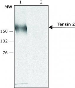 Anti-Tensin 2 (C-terminal) antibody produced in rabbit 