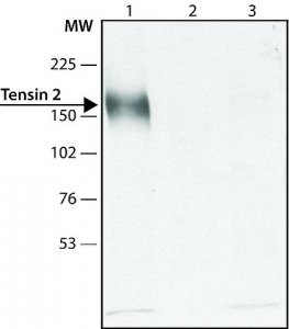 Anti-Tensin 2 (C-terminal) antibody produced in rabbit 