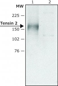 Anti-Tensin 2 (N-terminal) antibody produced in rabbit 