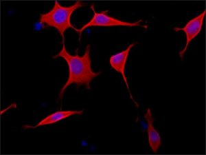 Anti-Tensin 2 (N-terminal) antibody produced in rabbit 