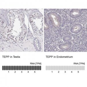 Anti-TEPP antibody produced in rabbit 
