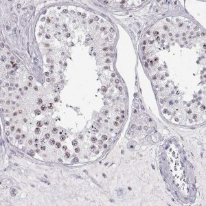 Anti-TEPP antibody produced in rabbit 