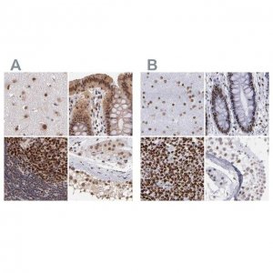 Anti-TERF2 antibody produced in rabbit 