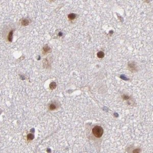 Anti-TERF2 antibody produced in rabbit 