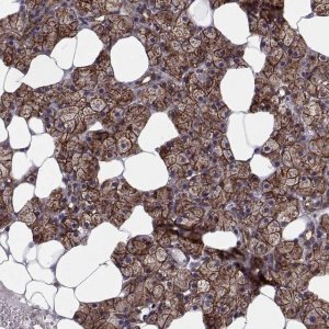 Anti-TESC antibody produced in rabbit 