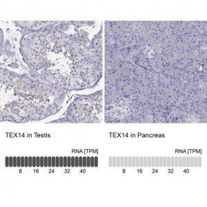 Anti-TEX14 