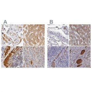 Anti-TF antibody produced in rabbit 