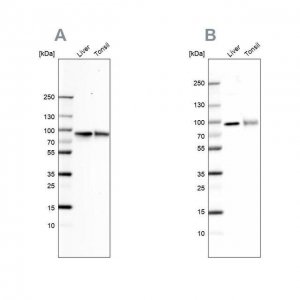 Anti-TF antibody produced in rabbit 