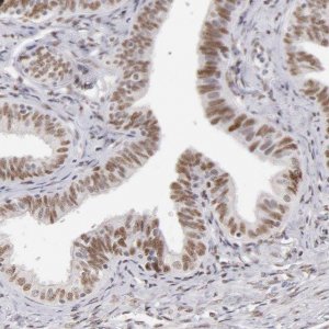 Anti-TFAP4 antibody produced in rabbit 
