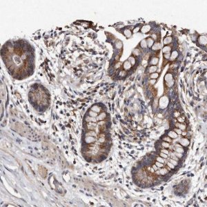Anti-TFB1M antibody produced in rabbit 