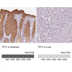 Anti-TFF1 antibody produced in rabbit 