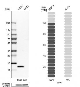Anti-TFF1 antibody produced in rabbit 