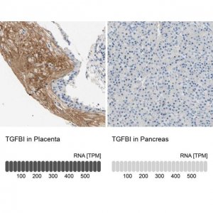 Anti-TGFBI antibody produced in rabbit 