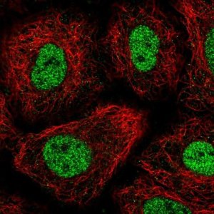 Anti-TGIF1 antibody produced in rabbit HPA062160-100UL