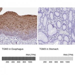 Anti-TGM3 antibody produced in rabbit HPA004728-100UL