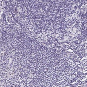 Anti-TGM3 antibody produced in rabbit HPA004728-100UL