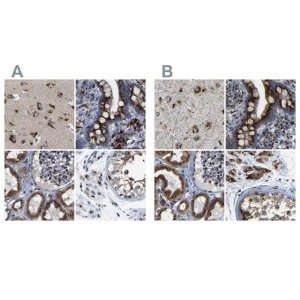 Anti-TGOLN2 antibody produced in rabbit 