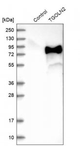 Anti-TGOLN2 antibody produced in rabbit 