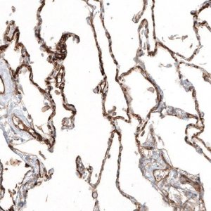 Anti-THBD antibody produced in rabbit HPA002982-100UL
